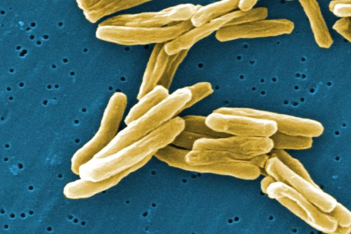 Genoscreen, the world leader in tuberculosis genotyping