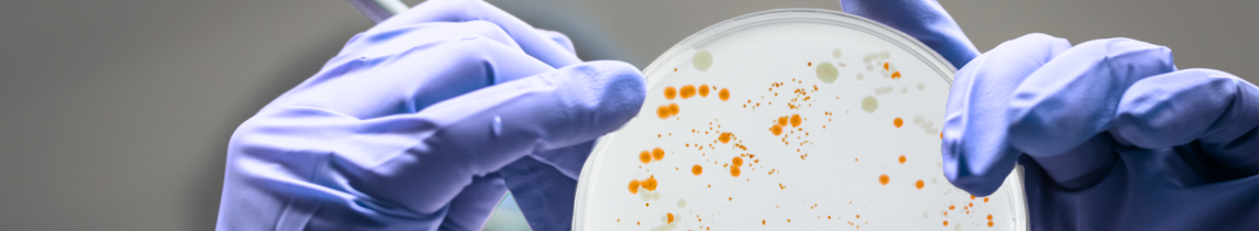 Métagénomique pour l'analyse des microbiomes