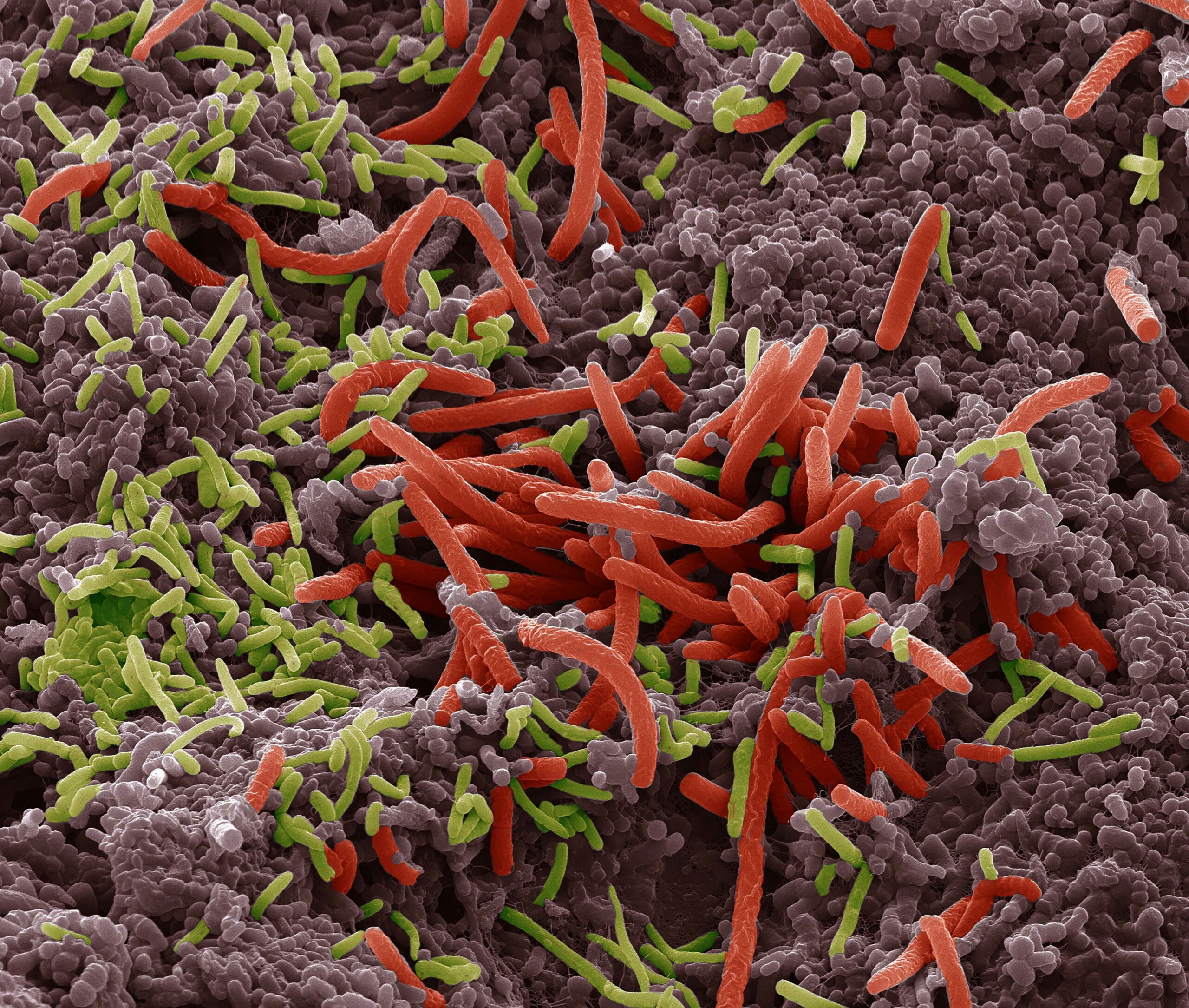 Intestinal microbiota